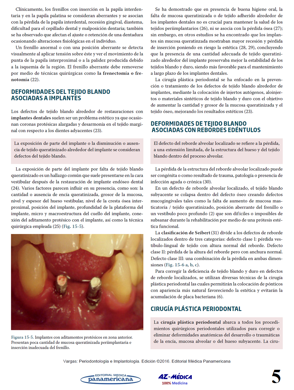 Cirugía Plástica Periodontal - Fuente:  Periodontología e Implantología - Vargas Casillas - 9786079356910